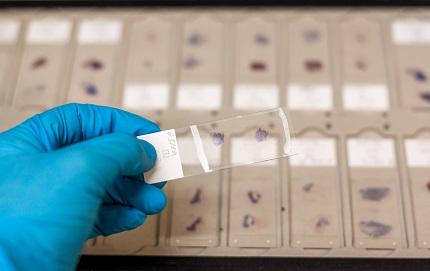 biobank---specimen-processing.jpg